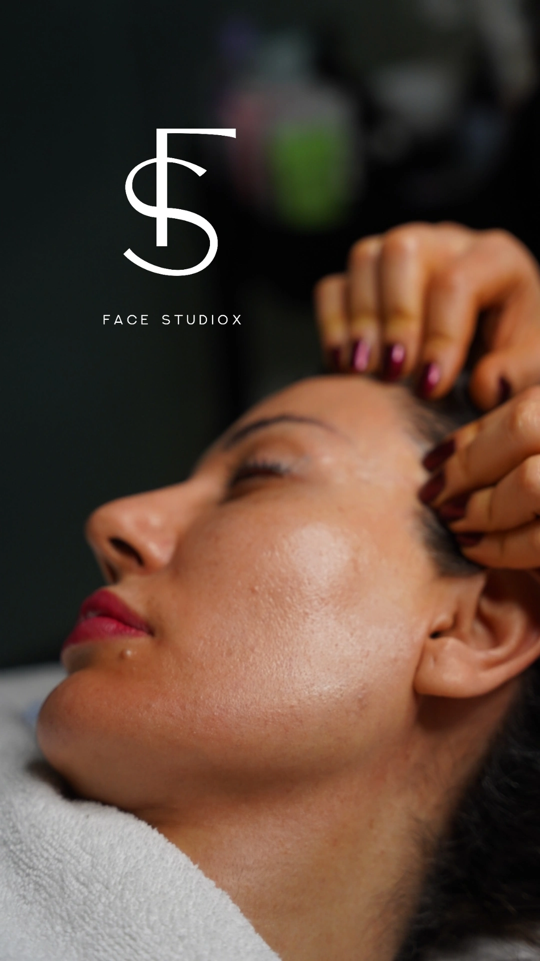 جلسه اسید تراپی تخصصی برای بازسازی پوست – فیس استودیوکس الهیه