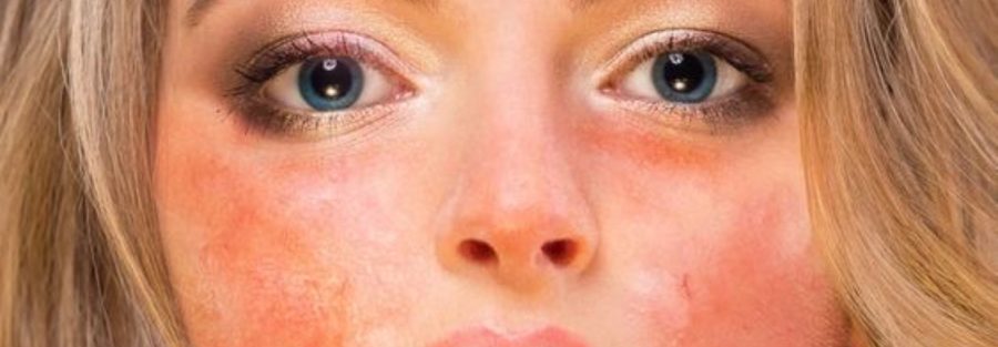 عوارض ماسک خانگی برای پوست صورت